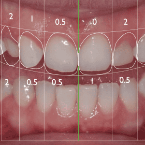 Digital Smile Design- Il tuo nuovo sorriso Digital Smile Design- Il tuo nuovo sorriso
