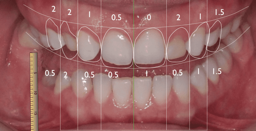 Digital Smile Design- Il tuo nuovo sorriso