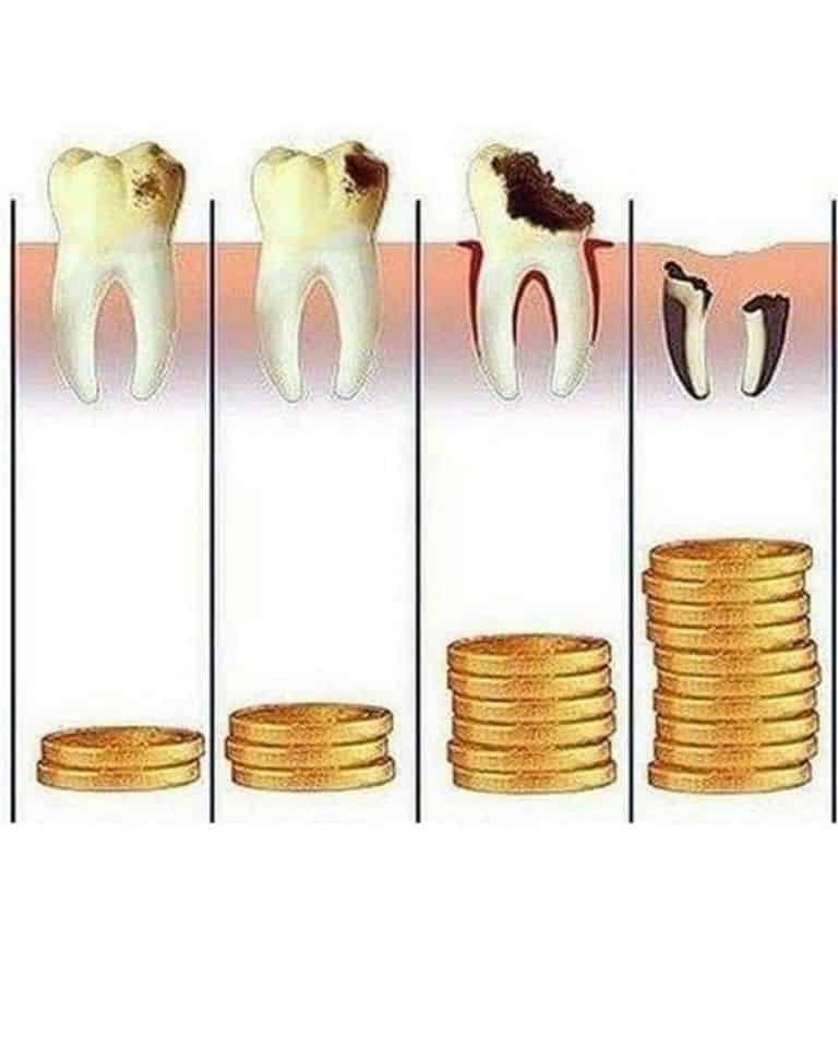 Odontoiatria mini-invasiva Odontoiatria mini-invasiva